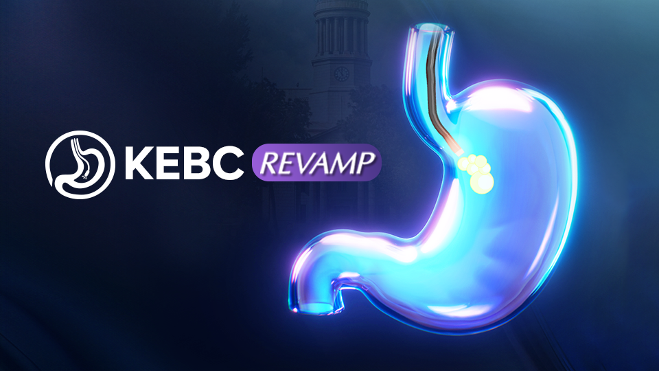 KEPC